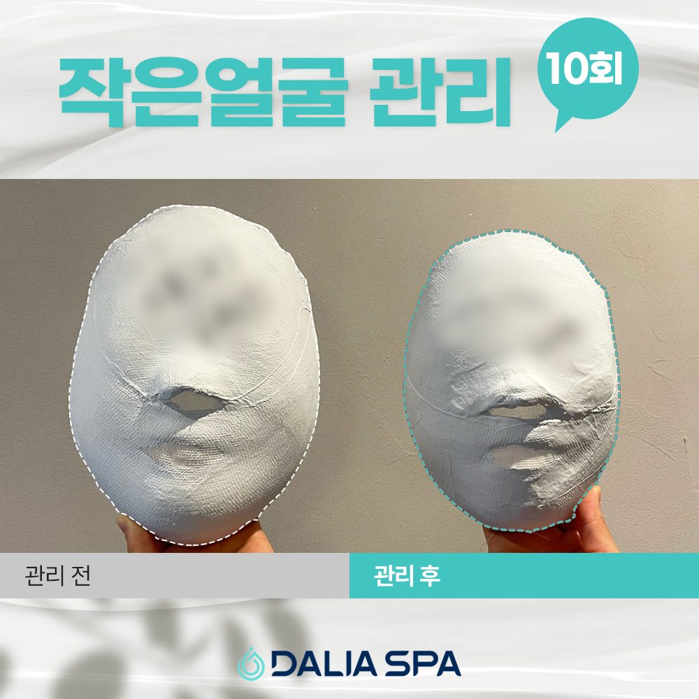 작은얼굴 관리
