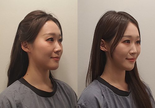 정민경 기상캐스터님