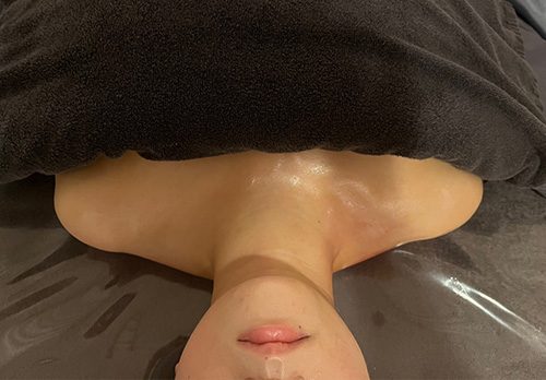 L라인 관리